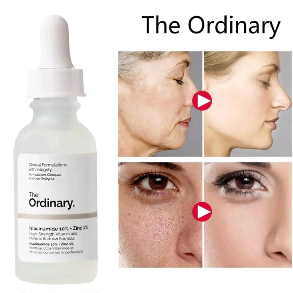 The Ordinary Niacinamide 10% + Zinc 1%, Smoothing Serum for Blemish-Prone Skin